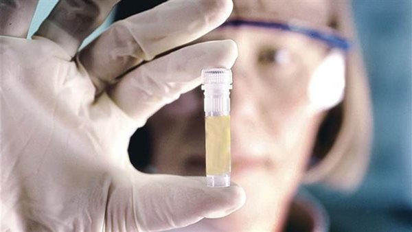 دراسة جديدة تؤكد العثور على فيروس كورونا في 