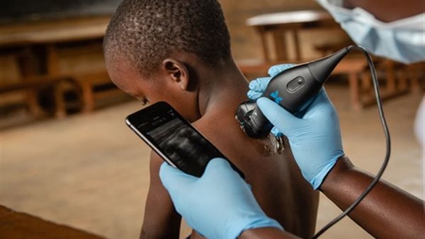 “عبداللطيف جميل” تتعاون مع “باترفلاي نتورك” لجلب أحدث تقنيات التصويرالطبي إلى الشرق الأوسط